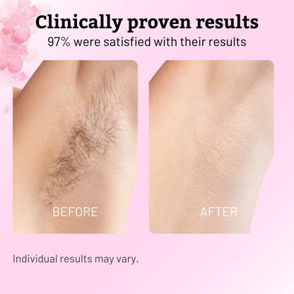 Cyperus Rotundus Oil - 60ml Natural Cyperus Rotundus Oil For Hair Removal, Moisturizing & Soothing Cyperus Oil For Reducing Body Hair Growth, Hair Removal Oil Ideal for All Skin Types